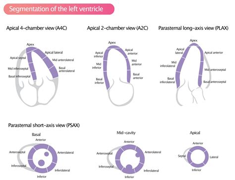 heart wall motion abnormalities.